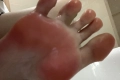 발갤러 발붕이 저격 젖은 앞꿈치 색감